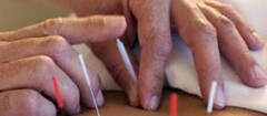 acupuntura-teresina-1377606673