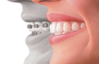 Odonto System Planos Odontológicos - Foto 1