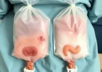bolsas de ostomia